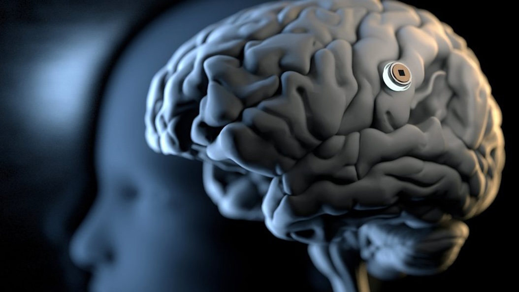 neuralink_brain